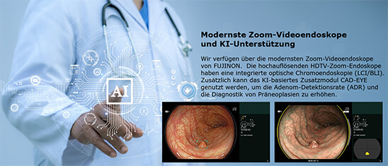Neue HDTV-Zoomendoskope mit KI-Modul